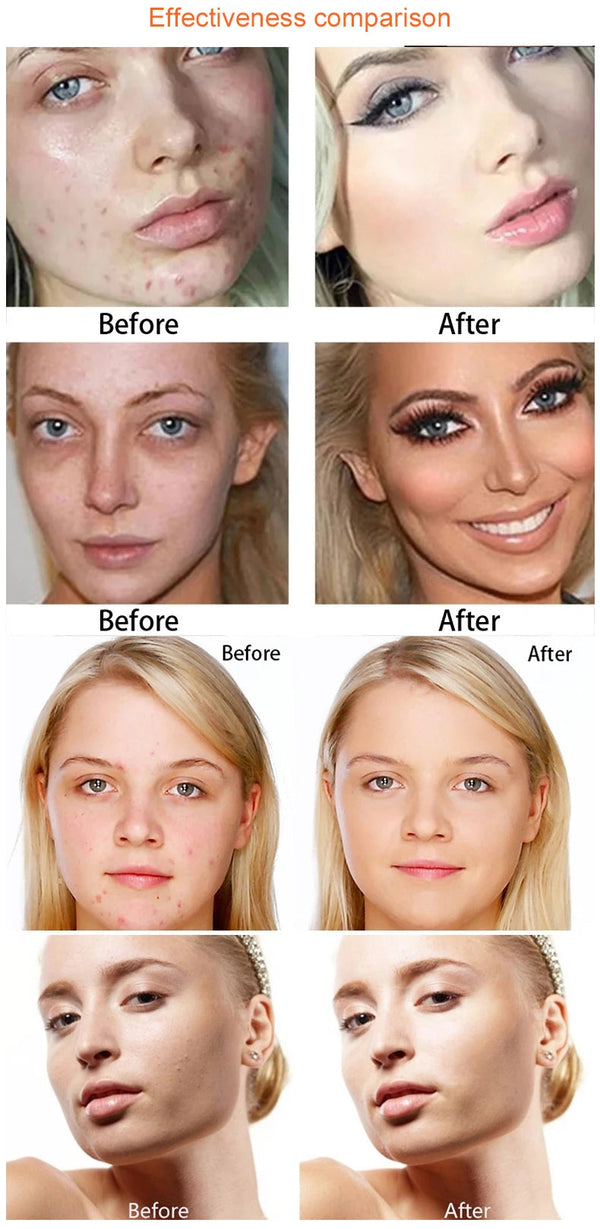 15 Colors Face Concealer Camouflage Cream Contour Palette Maquillaje Profesional Foundation Paleta Concealer NoirKiss