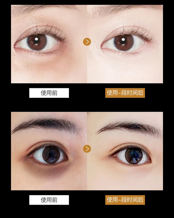 Skincare Products 24K Gold Hyaluronic Acid Eye Mask Remove Dark Eye Circles Collagen Eye Patches Korean Face Care Product NoirKiss