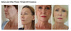 Face Filler Absorbable Collagen Protein Thread Face Lift Plump Silk Fibroin Line Carving Anti Aging Essence NoirKiss